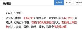 EGFR耐药、顽固胸水、高危术后辅助，多学科团队如何见招拆招？