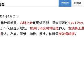 EGFR耐药、顽固胸水、高危术后辅助，多学科团队如何见招拆招？