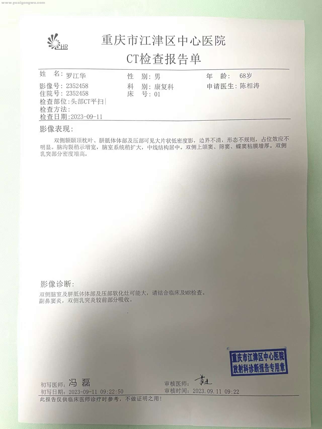 头颅CT平扫 9.11.jpg